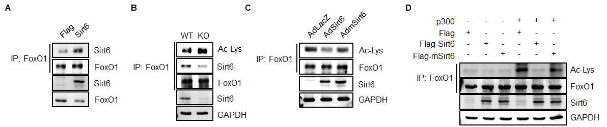 SIRT6에 의한 FOXO1의 탈 아세탈화 (A) 세포 내 SIRT6와 FOXO1의 interaction 확인, (B) WT과 KO 마우스에서 islets분리 후 KO에서 FOXO1의 아세틸화가 증가됨을 확인, (C) C57BL/6 마우스에서 islet분 리 SIRT6와 mutant SIRT6를 과발현 시킨 후 FOXO1의 탈 아세틸화 확인, (D) 세포 내 SIRT6와 mutant SIRT6를 과발 현 시킨 후 FOXO1의 탈 아셀틸화 확인