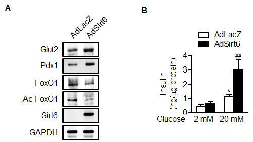 그림 11 (A) KO 마우스의 islets 분리 후 SIRT6에 의한 PDX1, Glut2의 발현 및 (B) glucose stimulated insulin secretion이 rescue 되어짐을 확인
