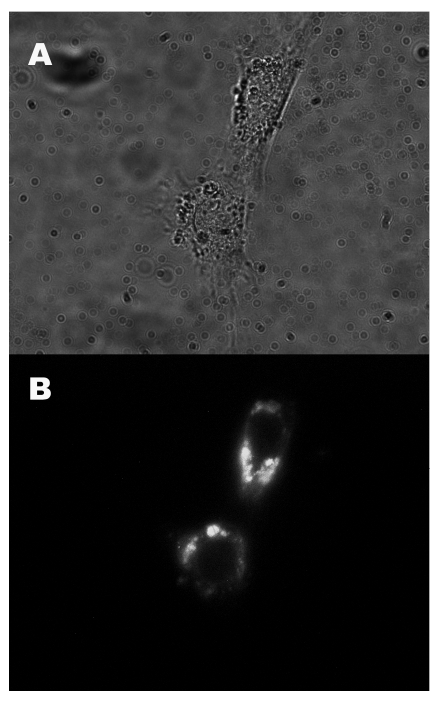 Fixed NIH 3T3 cells incubated with gold ions show luminescence images after photoactivation. A) Bright field image and B) Luminescence image shows that the emission species mainly locate in cytoplasm