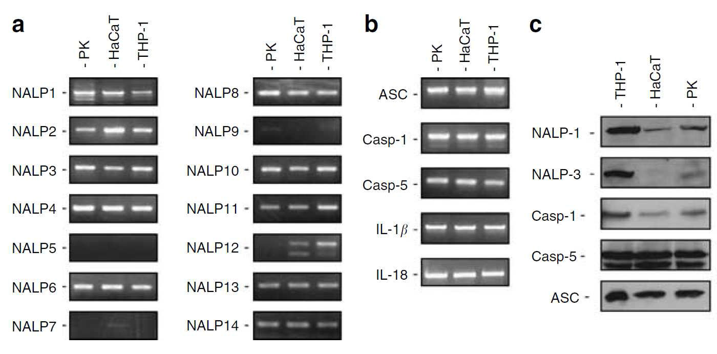각질형성세포 (일차세포, HaCaT 세포주), THP-1(단핵구 계열)세포에서 발현하는 14 종류의 NALP유전자와 ASC, caspase-1등을 RT-PCR과(a, b) 면역블럿(c)으로 측정한 것[3].