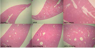 Histological assessment of the liver of control or APAP-induced liver injury with or without rhTrx-1 pretreatment.