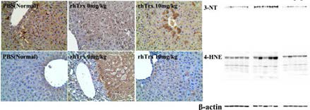 Effects of rhTrx-1 on RNS and ROS in the mice administered with APAP overdose