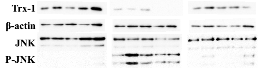 Endogenous Trx, JNK and p-JNK of the APAP-injured livers with or without rhTrx-1 pretreatment