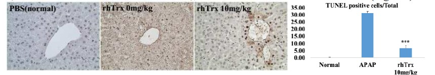 TUNEL-stained liver sections. rhTrx-1 pretreatment markedly decreased the percentage of TUNEL-positive hepatocytes from 31.3 ± 1.10 % to 6.61 ± 2.22 % at the concentration of 10 mg/kg/b.w.