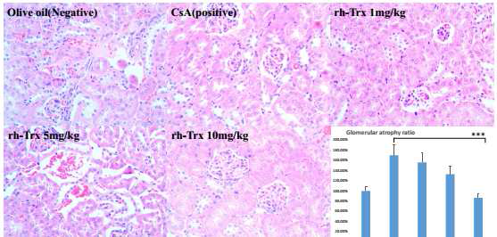 Histopathology of the kidney in the mice with CsA.