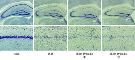 Cresyl violet stain for detection of alive neuron following Ischemia/repersfusion-induced brain injury