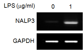 내독소 처리에 따른 inflammasomes의 유닛인 NALP3 유전자 발현