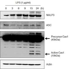 내독소 처리에 따른 시간 별 inflammasomes의 유닛인 NALP3, ASC, active Caspase-1 발현