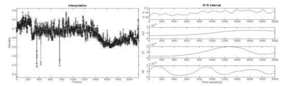 HRV 분석을 위한 새로운 신호처리기법