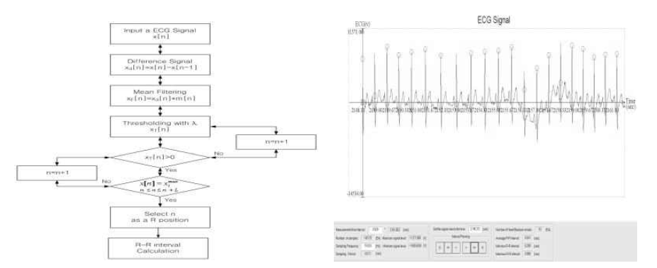 R wave Auto-detection 알고리즘 및 프로그램