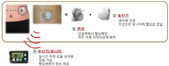 Medtronic사의 Guardian Real-Time 연속 혈당모니터링 시스템