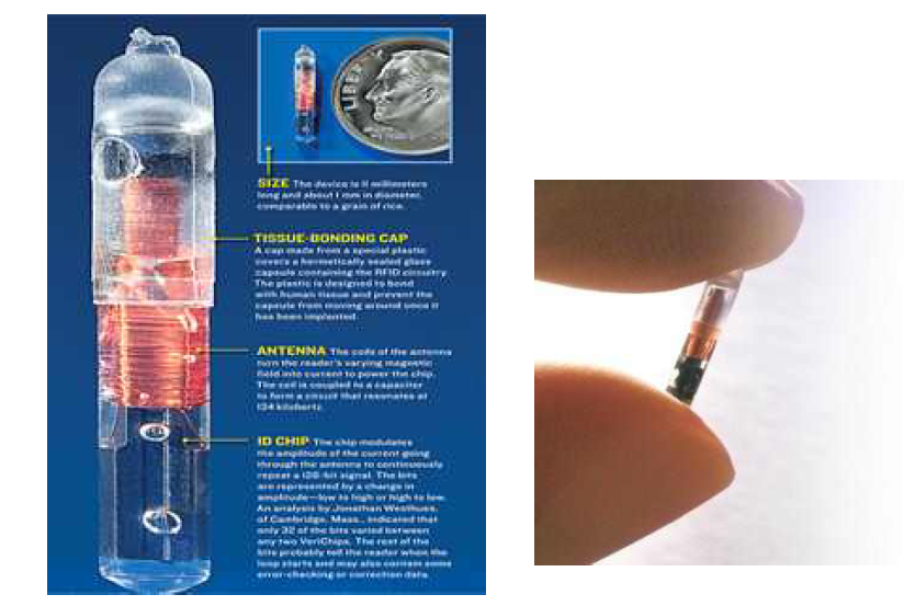Verichip 사가 개발한 인체 이식형 칩