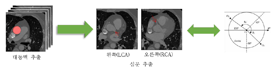 주요혈관 레이블링을 위한 대동맥과 심문추출 결과