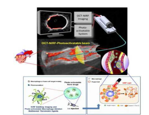 카테터 기반 혈관 내부 미세구조 및 분자영상 동시 획득 기술 개념도