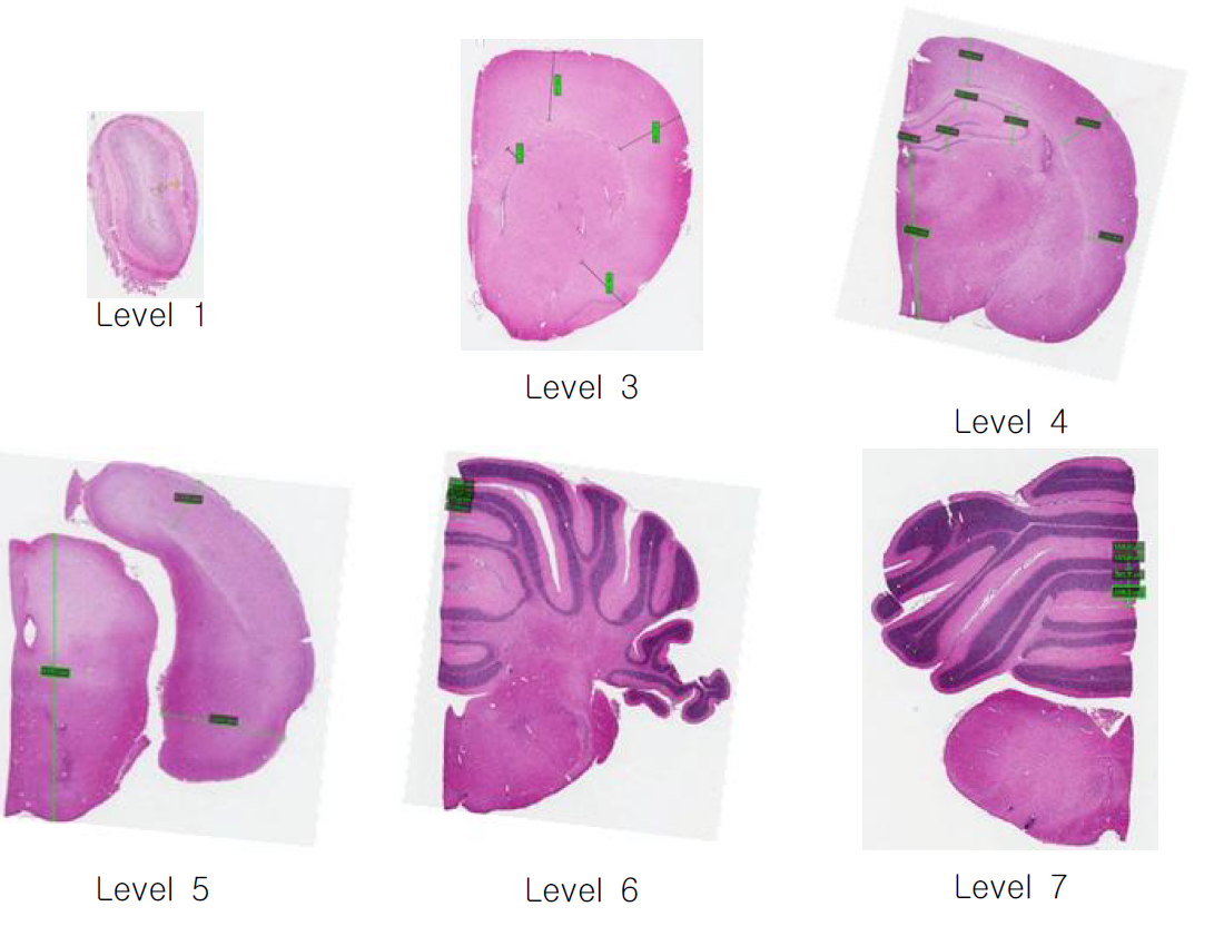 뇌조직의 Linear morphometry 측정을 위한 6가지 섹션부위