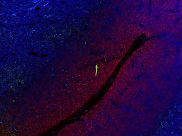 Alpha II spectrin single stain.