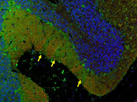 Alpha II spectrin과 SOD1에 대한 2-plex IHC 결과