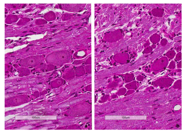 Acrylamide 투여 관련 요부 신경절(lumbar dorsal root ganglion)의 조직 소견