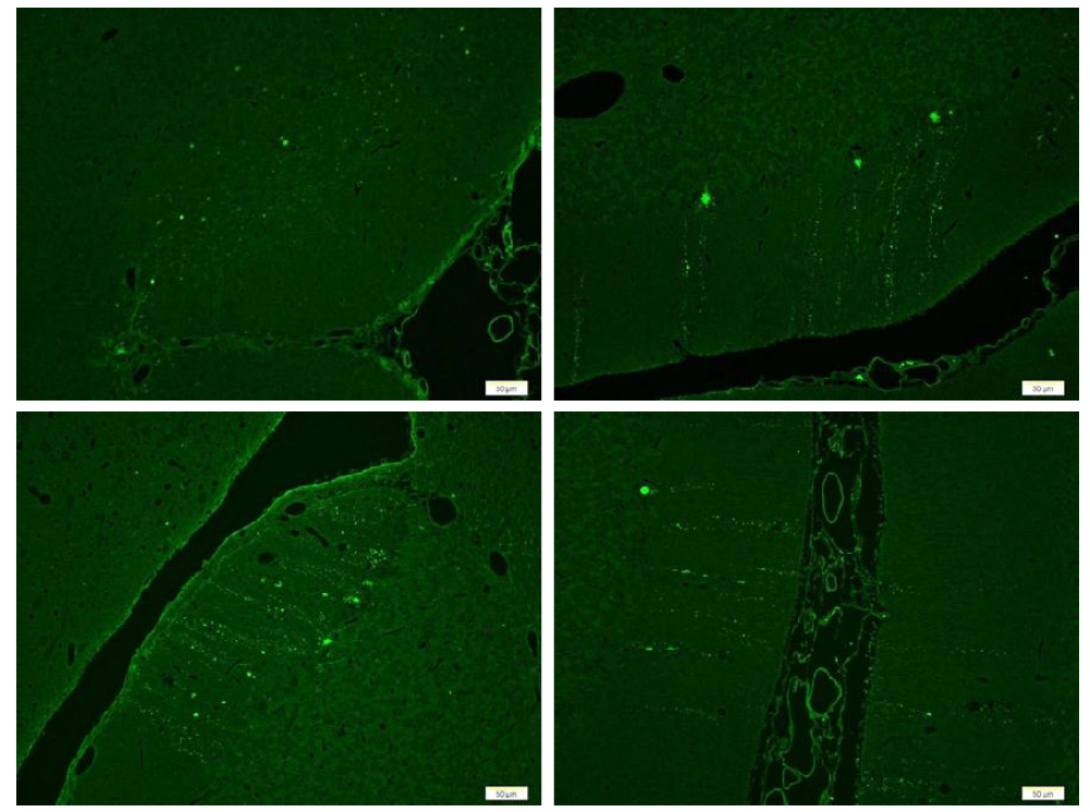 변성 또는 괴사 신경원 세포에 특이적으로 발색되는 Fluoro-Jade B 염색사진
