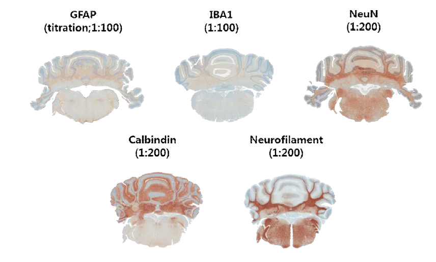 신경구조와 관련된 단백에 대한 immunohistochemistry 결과 (5종)