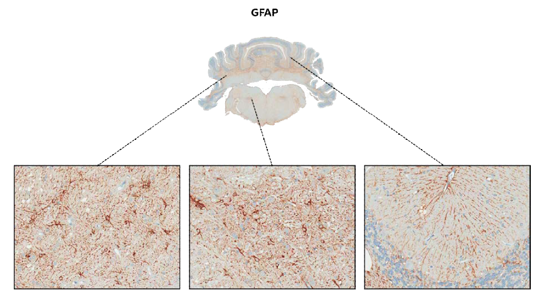 GFAP; astrocyte를 염색하기 위한 염색법으로 주로 연수와 white matter쪽에 양성을 나타냄.