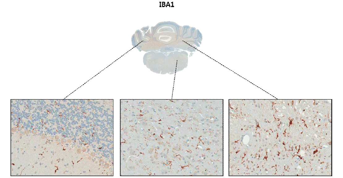 IBA-1; microglia의 marker로서 평상시에는 염색상이 약하지만 활성화시 아메바 타입으로 변형.