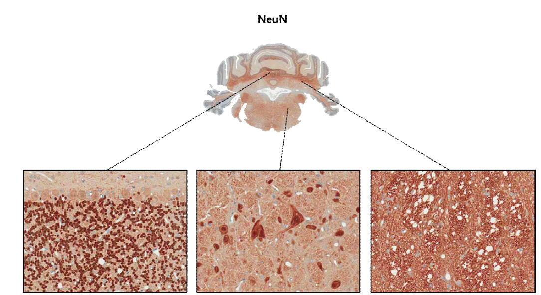 NeuN; neuronal marker로서 신경원을 주로 염색하나 일부 신경원의 경우 음성을 나타냄.