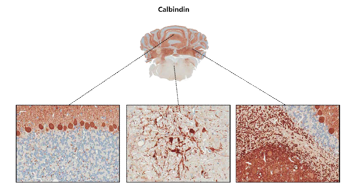 Calbindin D28K; purkinje cell marker로서 분자층(molecular layer)의 퍼킨제 세포의 dendrite도 양 성반응을 나타냄