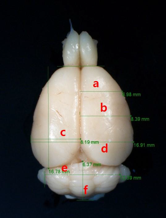 뇌 형태계측기술 중 macroscopic morphometry의 측정 방법.