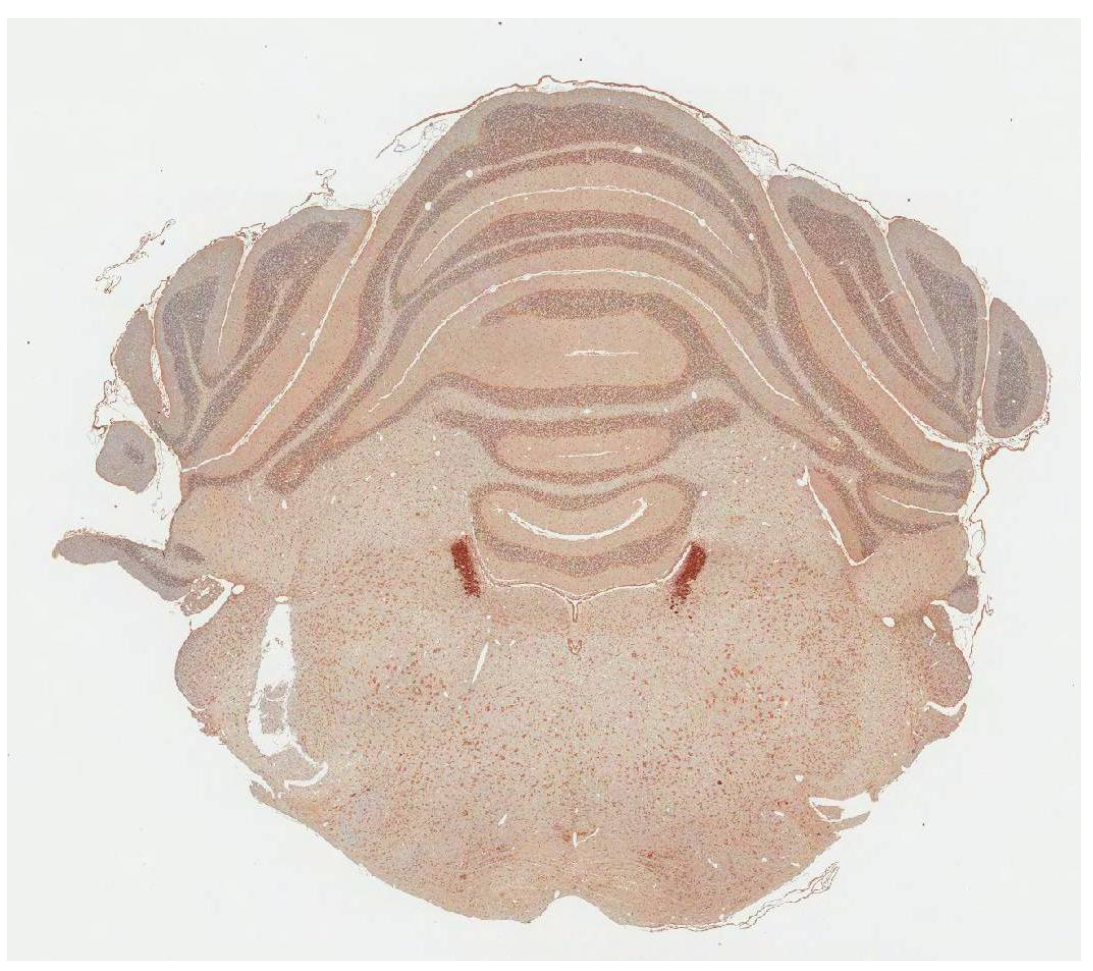 Tyrosine hydroxylase