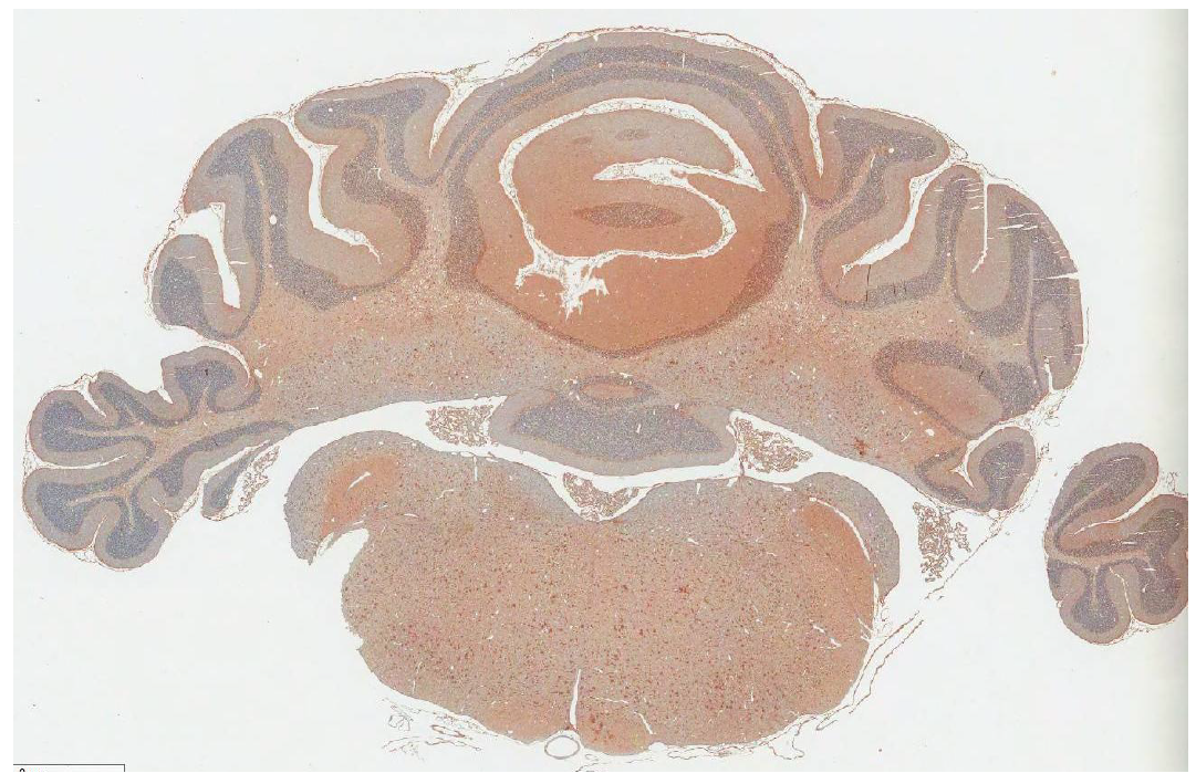 ChAT (acetylcholine 관련).