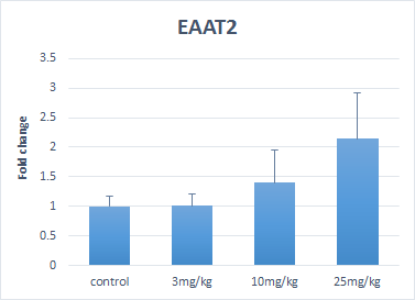 EAAT2의 발현양상