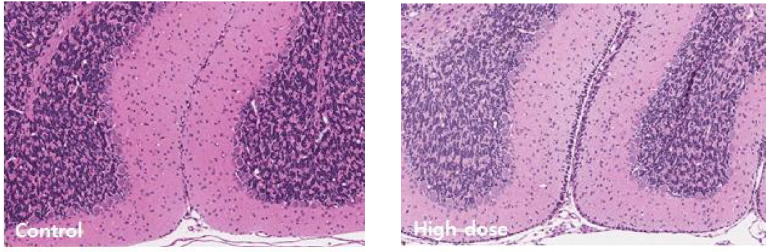 MMI 시험군의 소뇌병변부위 external granule cell layer의 모습.