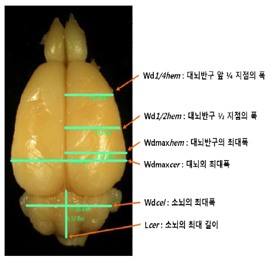 Brain morphometry의 측정부위