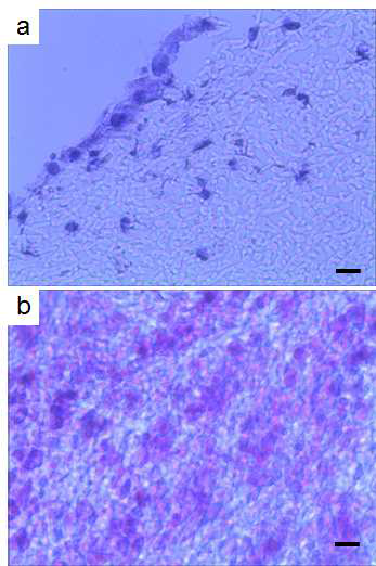 Histological image of electrospun PLGA at a) 7 days, b) 14 days of culture.