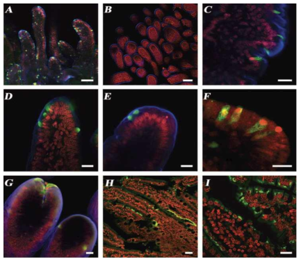 Confocal microscopy showing indirect immunofluorescent localization of the HuNoV capsid protein in small intestinal tissues from virus-inoculated gnotobiotic pigs