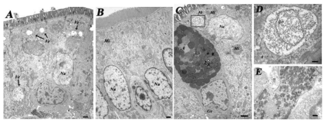 노로바이러스에 감염된 무균 돼지 공장 조직의 Transmission electron microscopy 사진