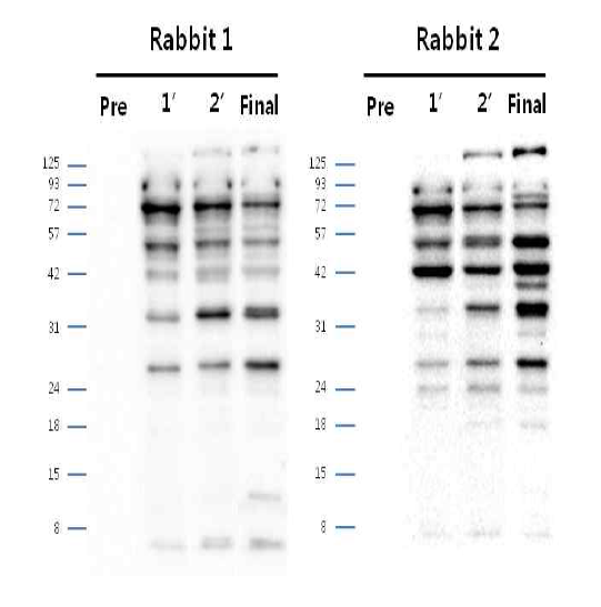 안정화된 CHO DP12-DHFR-IRES-pcDNA3.1(+) Polyclonal antibody (pre∼final serum)에서 단백질 발현 확인 결과