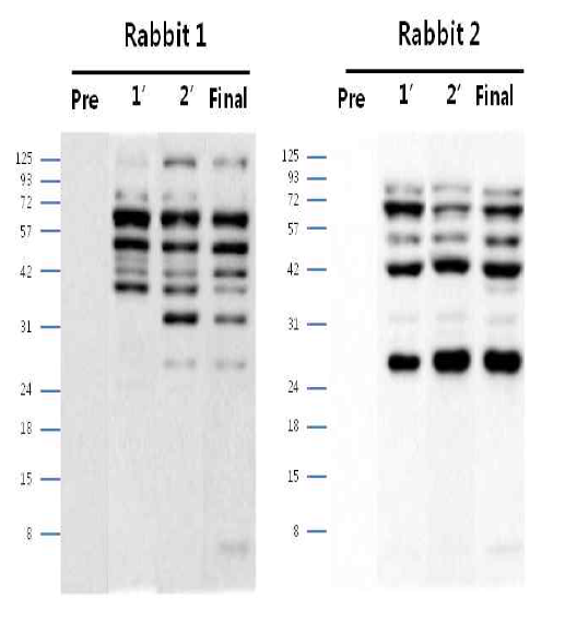 안정화된 CHO DXB11-DHFR-pcDNA3.1(+) Polyclonal antibody (pre∼final serum)에서 단백질 발현 확인 결과