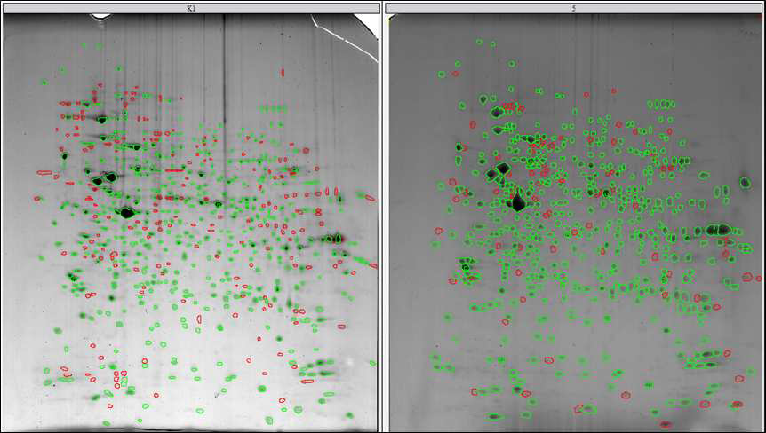 CHO K1과 CHO K1-GS-pcDNA3.1(+) 세포 단백질의 2D 이미지 비교 분석