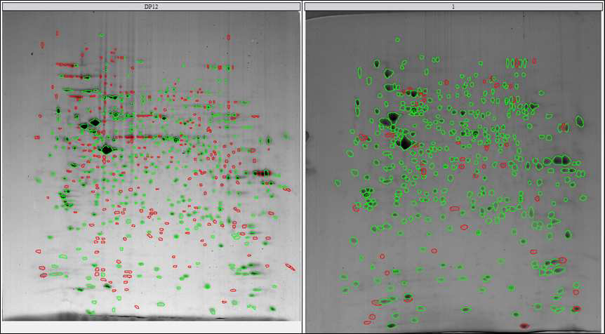 CHO DP12와 CHO DP12-DHFR-pSVI6B5 세포 단백질의 2D 이미지 비교 분석