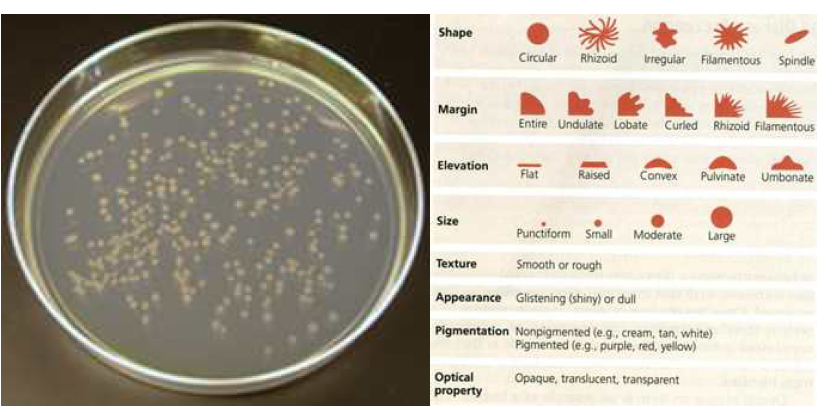 Microbial host cell (E.coli)의 전형적인 morphology