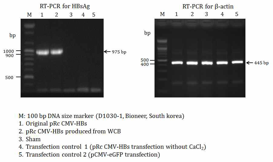 RT-PCR에 의해 HBsAg mRNA 발현 분석