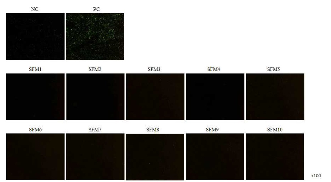 CAR bacillus IFA 결과