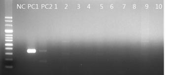 Pneumocystis carinii(356bp) & Pneumocystis murina(364bp) PCR 결과