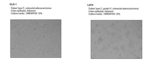 DLD-1과 LoVo 세포주 morpholohy