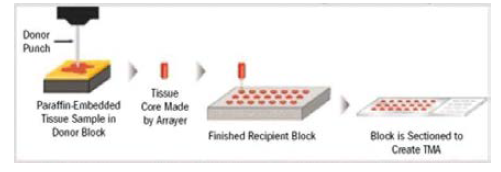Tissue microarray의 제작 과정