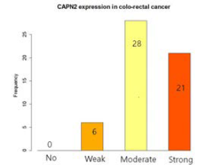 CCRT받은 대장암세포에서의 CAPN2 발현.