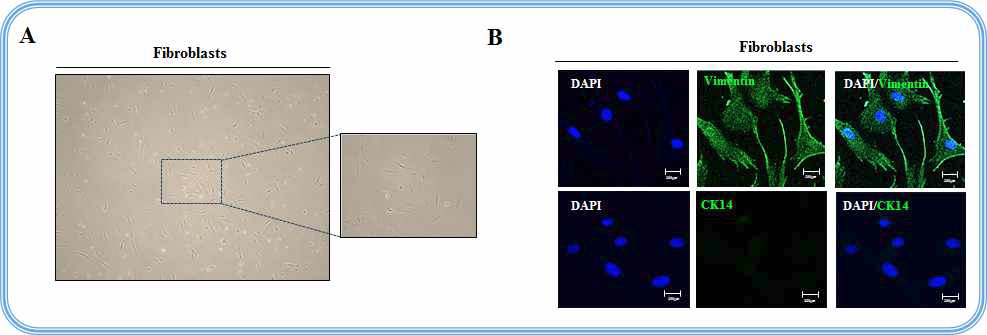 인간 피부 조직에서 섬유아세포의 분리 및 특성 확인