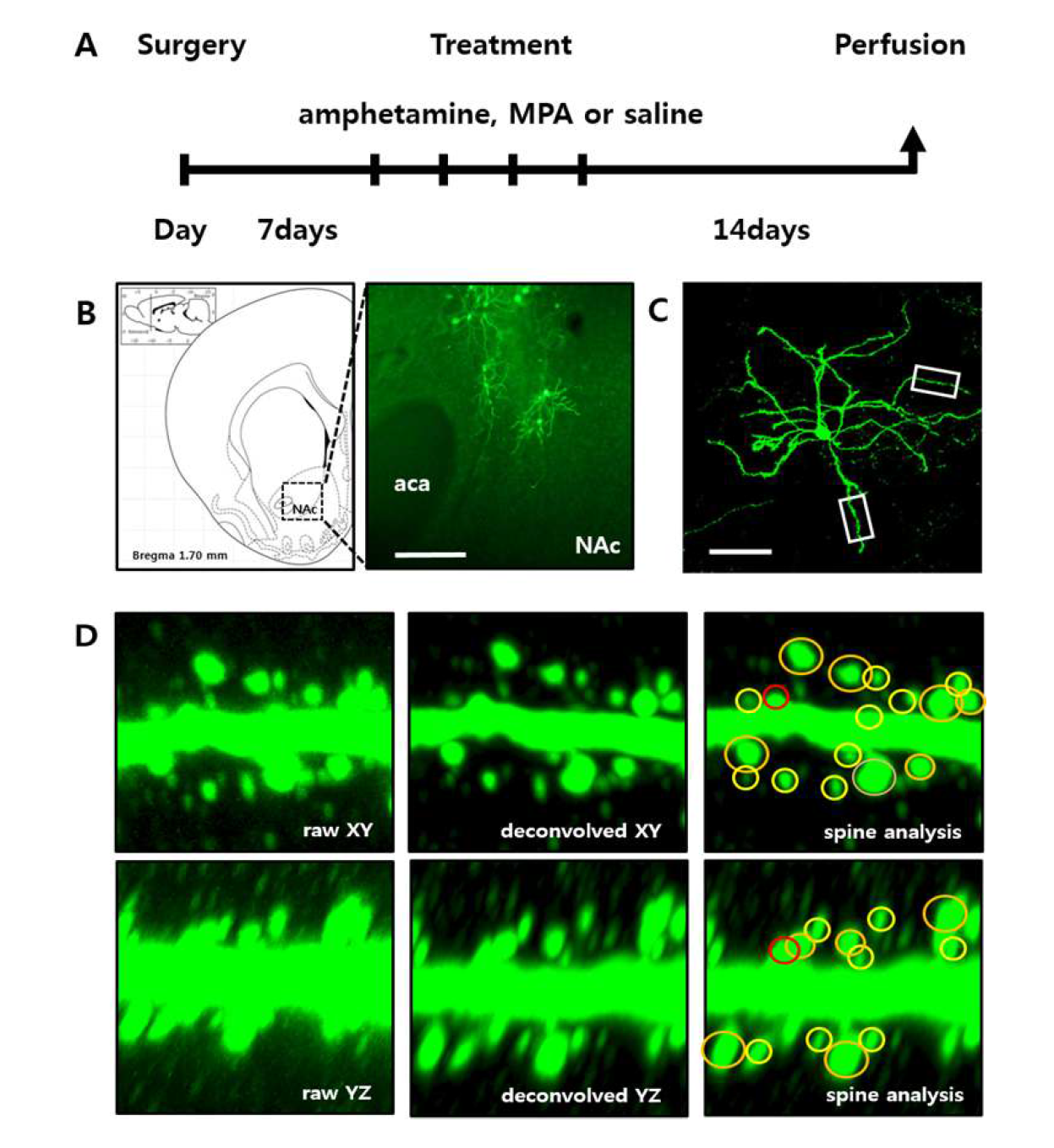 Saline, MPA, amphetamine을 각각 반복적으로 주고 2주 후에 brain을 적출하여 sucrose용액에 담가둔 뒤, nucleus accumbens 조직을 slice 하여 GFP 항체로 염색을 하고, Neuron Studio를 이용하여 dendritic spine의 수와 모양을 분석하였다.
